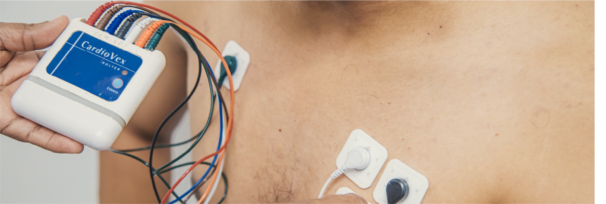 Holter 24 horas - CEMDE